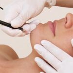 electrolysis hair removal in Cardiff